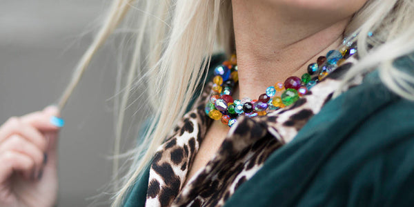 Dagens outfit | Kan vi få nok af smukke leopard-prikkede kjoler???